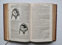 Dictionnaire encyclopédique des sciences médicales (…). - photo