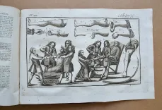 Institutions de chirurgie, où l’on traite dans un ordre clair et nouveau de tout ce qui a rapport à cet art : ouvrage de près de quarante ans, orné d’un grand nombre de figures en taille-douce, qui représentent les instrumens le plus approuvés & les plus utiles, le manuel des opérations, les appareils & les bandages (…). [Suivi de :] Mémoires pour servir à l’histoire de la chirurgie du XVIII° siècle, et de supplément aux Institutions chirurgicales de M. Heister (…). - photo