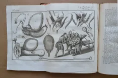 Institutions de chirurgie, où l’on traite dans un ordre clair et nouveau de tout ce qui a rapport à cet art : ouvrage de près de quarante ans, orné d’un grand nombre de figures en taille-douce, qui représentent les instrumens le plus approuvés & les plus utiles, le manuel des opérations, les appareils & les bandages (…). [Suivi de :] Mémoires pour servir à l’histoire de la chirurgie du XVIII° siècle, et de supplément aux Institutions chirurgicales de M. Heister (…). - photo