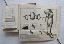 Dictionnaire de chirurgie, communiqué à l’Encyclopédie par M. Louis, secrétaire perpétuel de l’Académie Royale de Chirurgie, professeur royal de physiologie (…).
Extrait et rédigé par M.P.F. Docteur en Médecine & membre de plusieurs Académies. - photo